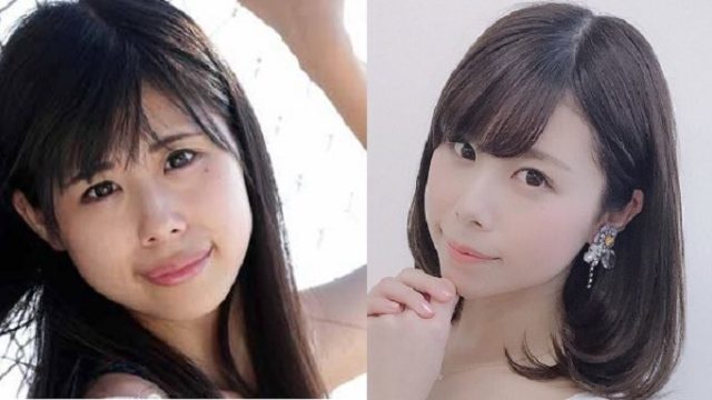 有村愛理が美容整形を公表
